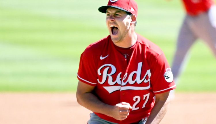 Trevor Bauer's $102 million deal with the Dodgers is unique — Here's why