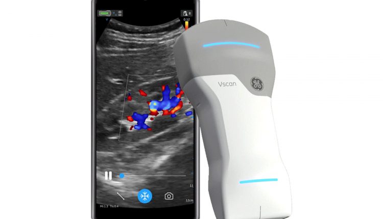 GE Healthcare launches new wireless hand-held ultrasound as CEO eyes growing market