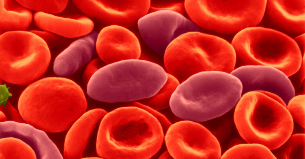 Sickle Cell Treatment Not Linked to Cancer, Researchers Say