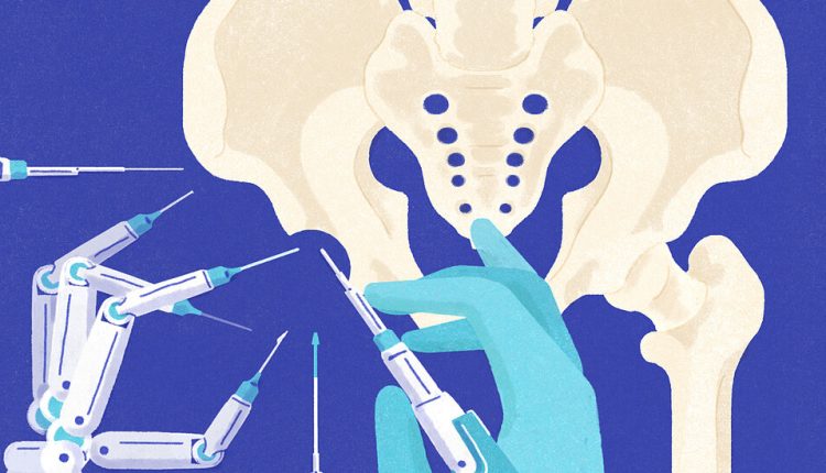 It’s Not Your Parents’ Hip Replacement Surgery
