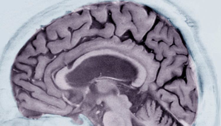Alzheimer’s Prediction May Be Found in Writing Tests