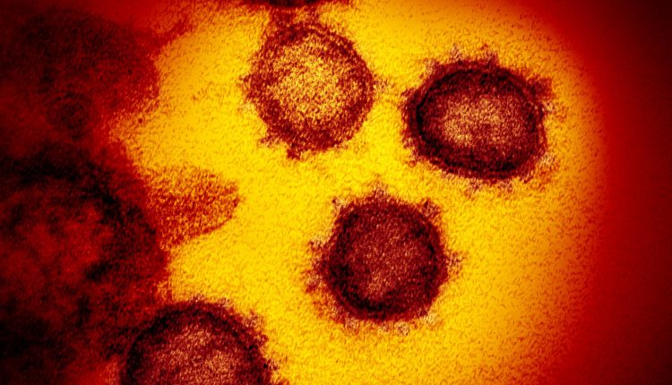 Here's everything you need to know