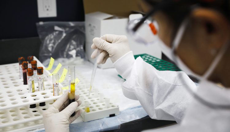 Food and its packaging are highly unlikely to transmit virus