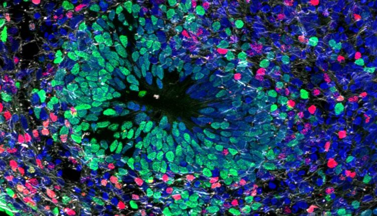 Tiny Blobs of Brain Cells Could Reveal How Your Mind Differs from a Neanderthal’s