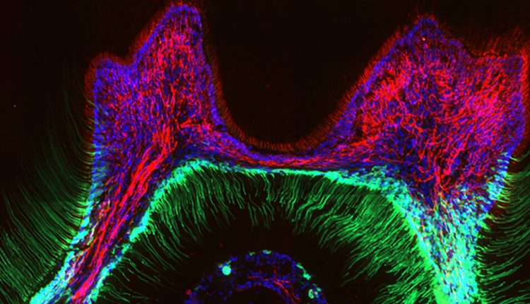 Cold Tooth Pain's Mysterious Molecular Culprit