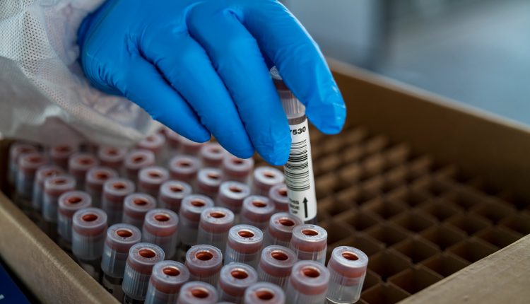Researchers identify five new cases of variant in California